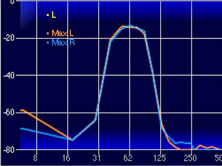 Son Technique BMF